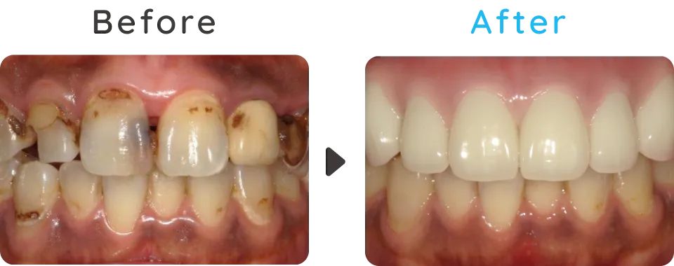 Before After03