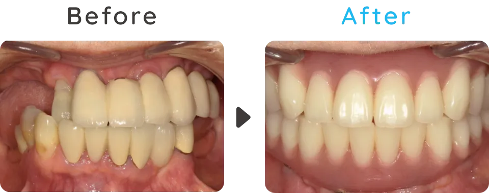 Before After04