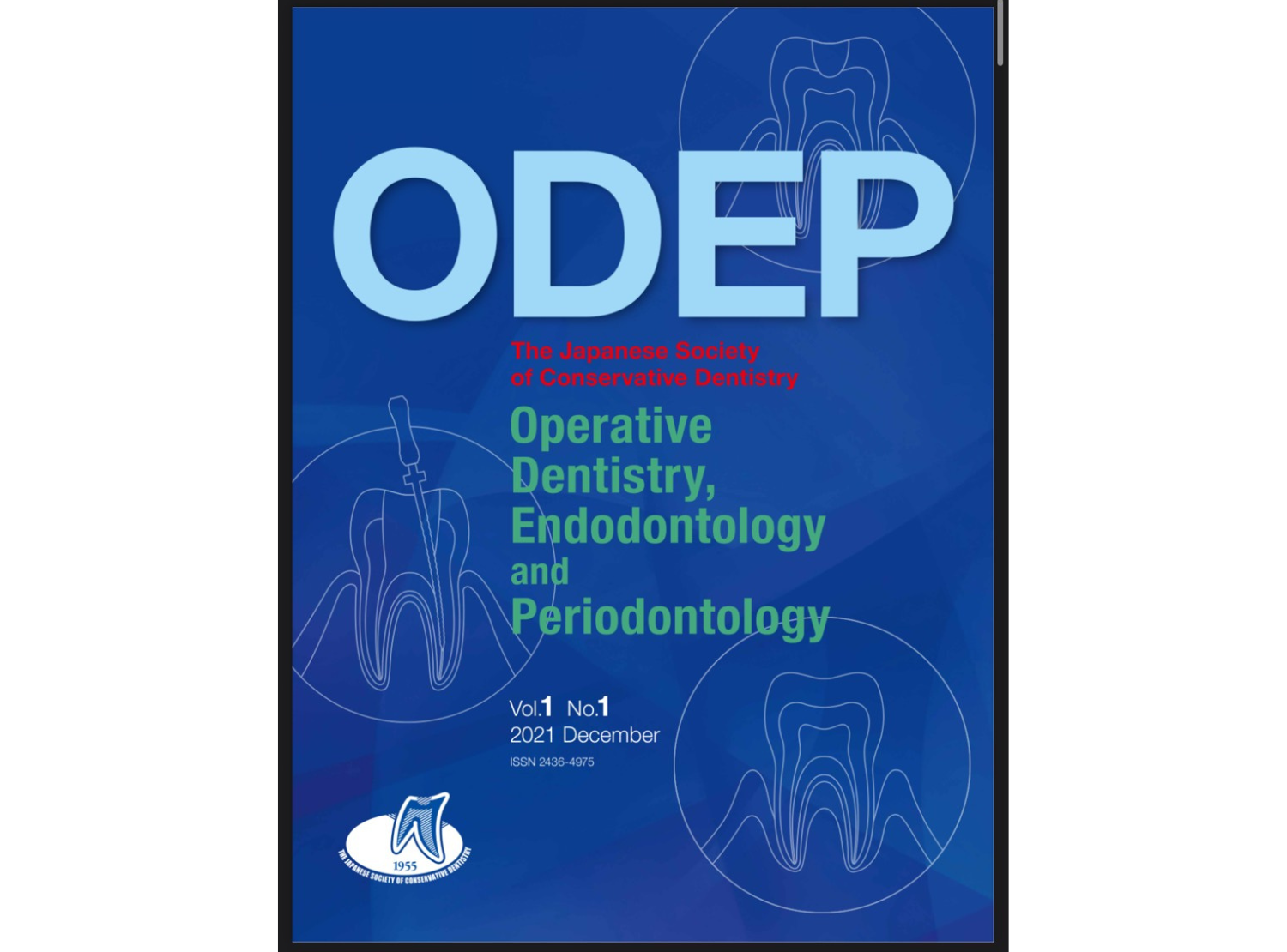 2021年 論文発表:Effects of Universal Adhesives on Dentin Adhesive Performance and Acid-base Resistance